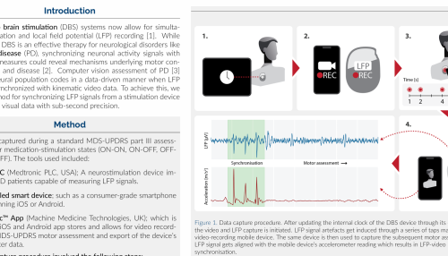 A Simple Method for Synchronising Rich Kinematic Video Data with Local Field Potentials from DBS Systems